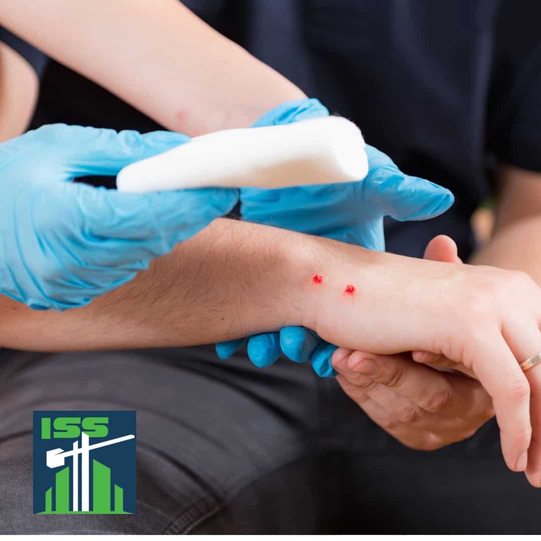Read more about the article What’s Up Wednesday – Preventing bites and how to triage